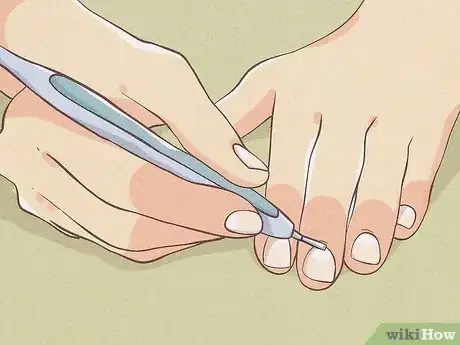 Image titled Make Your Fingernails Look Good Step 6