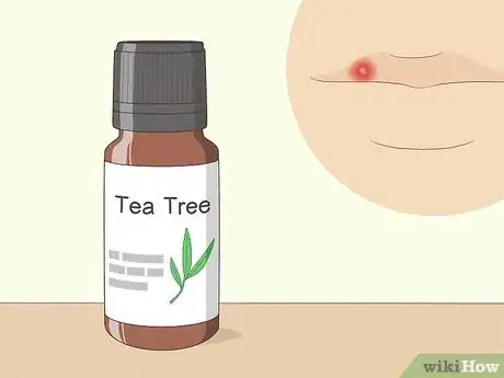 Image titled Treat Cold Sores with Essential Oils Step 3