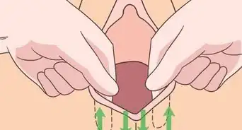 Do Perineal Massage