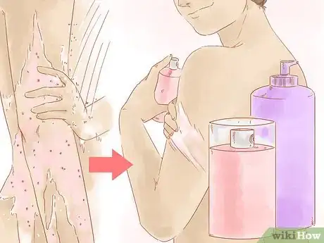 Image titled Exfoliate Your Body for Soft Skin Step 10