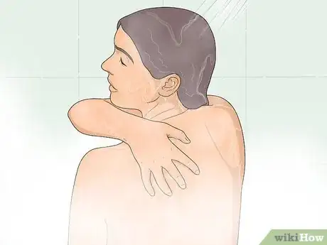 Image titled Naturally Get Rid of Back Acne Step 1