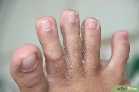 Image titled Wiggle Your Small Toe Separately from the Rest of Your Toes Step 5