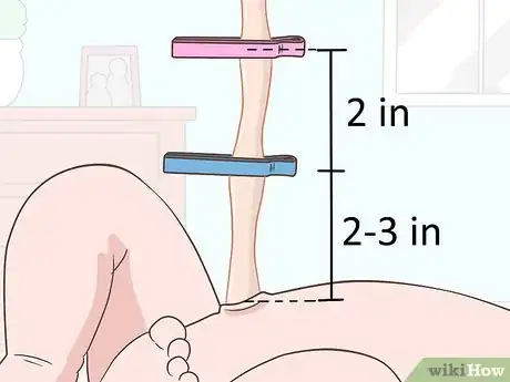 Image titled Cut the Umbilical Cord of a Baby Step 12