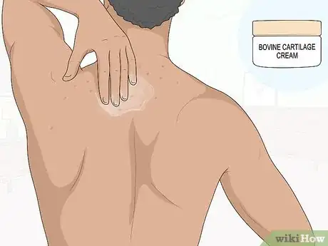 Image titled Naturally Get Rid of Back Acne Step 12