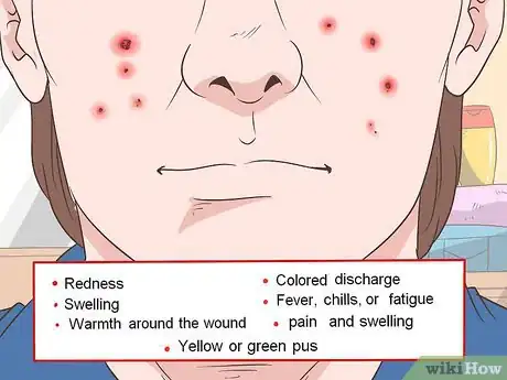 Image titled Quickly Heal Open Sores on Your Face Step 6