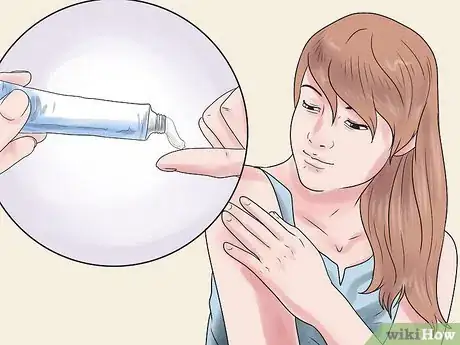 Image titled Get Rid of a Skin Rash Caused by Antibiotic Allergy Step 11