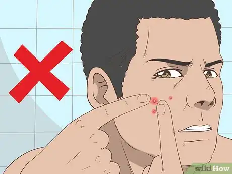 Image titled Quickly Heal Open Sores on Your Face Step 13